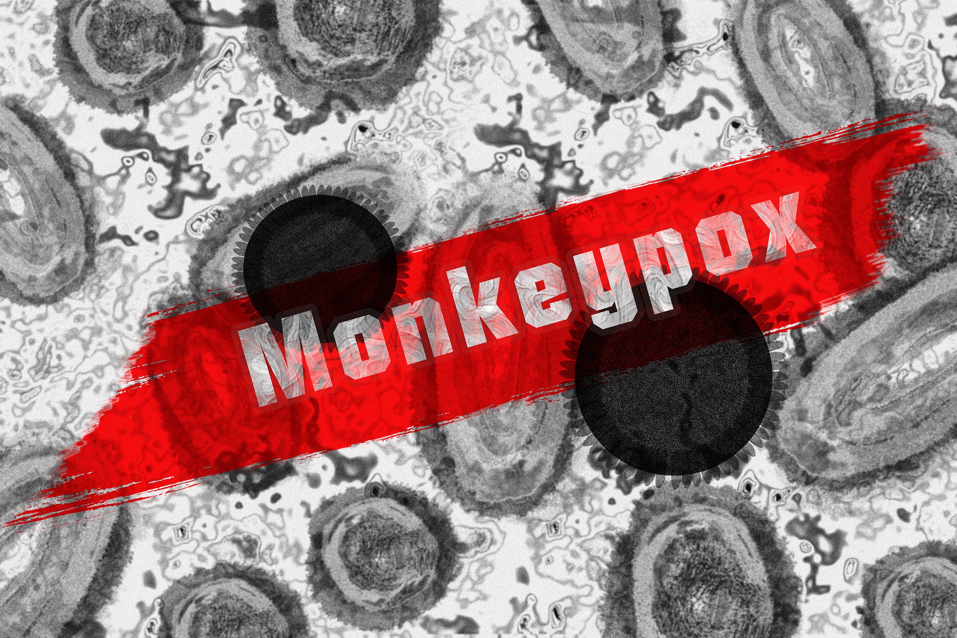 0.0002% of the world has Monkeypox… time to PANIC!!!